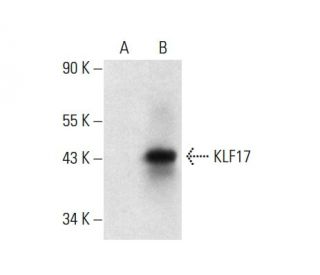 KLF17 Antibody (B-6) - Western Blotting - Image 301412SAM Transcription Activation: SAM system utilizing dCas9-VP64, MS2-P65-HSF1, and sgRNA for precise gene transcription activation.