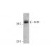 KLF3 Antibody (H-8) - Western Blotting - Image 384491 