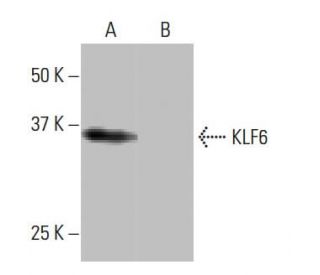 KLF6 Antibody (2F5) - Western Blotting - Image 64985