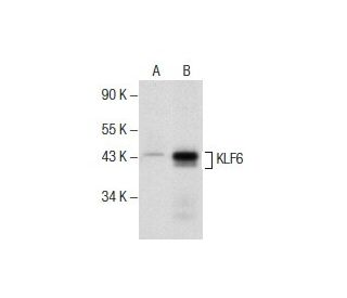 KLF6 Antibody (E10) Western Blotting Image 157488
