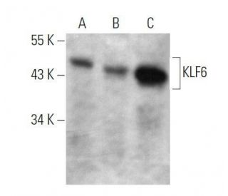 western blotting image from recommended KLF6 (E-10) monoclonal antibody replacement. Image 356233