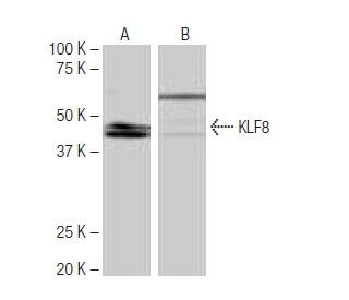 KLF8 Antibody (12D2) - Western Blotting - Image 64986
