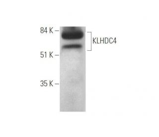KLHDC4 Antibody (E-4) - Western Blotting - Image 349071