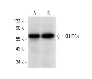 KLHDC4 Antibody (H-9) - Western Blotting - Image 308056 