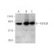 KLHL20 Antibody (D-7) - Western Blotting - Image 346535 