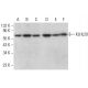 KLHL20 Antibody (D-7) - Western Blotting - Image 379822