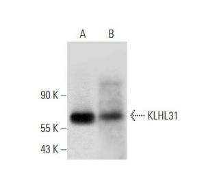 KLHL31 Antibody (E-2) - Western Blotting - Image 326543 