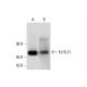KLHL31 Antibody (E-2) - Western Blotting - Image 326543 
