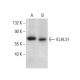 KLHL31 Antibody (E-2) - Western Blotting - Image 376425 