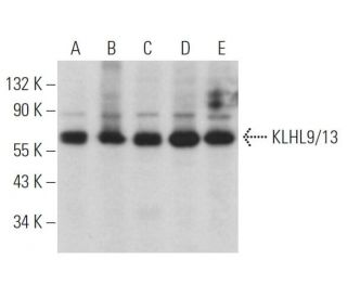 KLHL9/13 Antibody (D-4) - Western Blotting - Image 367725Each CRISPR/Cas9 Knockout (KO) Plasmid product consists of a pool of 3 plasmids designed to ensure identification and cleavage of a specific gene for maximum knockout efficiency. Each plasmid encodes a unique 20 nt sequence derived from the GeCKO (v2) library.