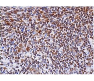 immunohistochemistry image from recommended KLK6 (D-1) monoclonal antibody replacement. Image 286258