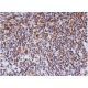 immunohistochemistry image from recommended KLK6 (D-1) monoclonal antibody replacement. Image 286258