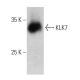 western blotting image from recommended KLK7 (H-5) monoclonal antibody replacement. Image 359435