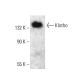 Klotho Antibody (A-9) - Western Blotting - Image 383893