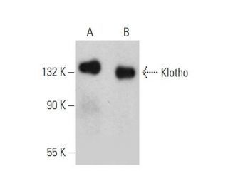 Klotho Antibody (A-9) - Western Blotting - Image 384258 