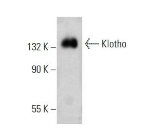 Klotho Antibody (D-4) - Western Blotting - Image 383042 