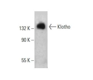 western blotting image from recommended Klotho (F-5) monoclonal antibody replacement. Image 383041