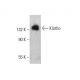 western blotting image from recommended Klotho (F-5) monoclonal antibody replacement. Image 383041