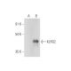 KLRG2 Antibody (B-12) - Western Blotting - Image 318405