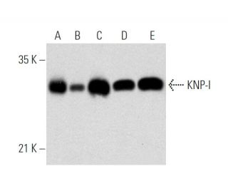 KNP-I Antibody (D-5) - Western Blotting - Image 319587 