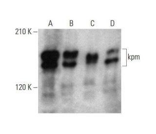 western blotting image from recommended kpm (C-2) monoclonal antibody replacement. Image 352593
