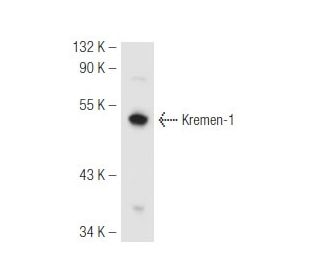 Kremen-1 Antibody (R17-2) - Western Blotting - Image 54626SAM Transcription Activation: SAM system utilizing dCas9-VP64, MS2-P65-HSF1, and sgRNA for precise gene transcription activation.