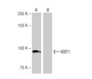 KRIT1 Antibody (8-RY2) - Western Blotting - Image 64987