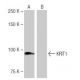 KRIT1 Antibody (8-RY2) - Western Blotting - Image 64987