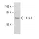 Krs-1 Antibody (87.K) - Western Blotting - Image 368267