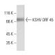 KSHV ORF 45 Antibody (2D4A5) - Western Blotting - Image 137439