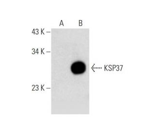 KSP37 (D-2): sc-365803. Western blot analysis of KSP37 expression in... 