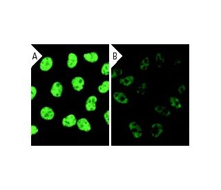 Ku70 siRNA (h): sc-29383. Immunofluorescence staining of methanol-fixed, control HeLa (A) and Ku70 siRNA silenced HeLa (B) 