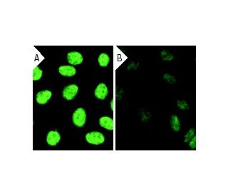 Ku86 siRNA (h) siRNA (h): sc-29384. Immunofluorescence staining of methanol-fixed, control HeLa (A) and Ku86 siRNA silence 