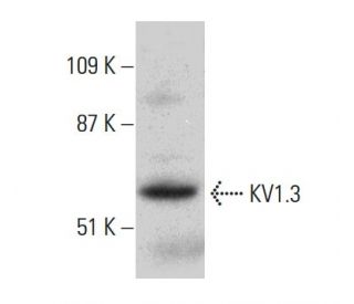 KV1.3 Antibody (G-9) - Western Blotting - Image 386837 