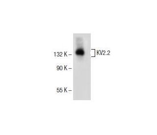 KV2.2 Antibody (E-7) - Western Blotting - Image 154945 