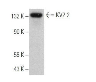 KV2.2 Antibody (E-7) - Western Blotting - Image 369752 