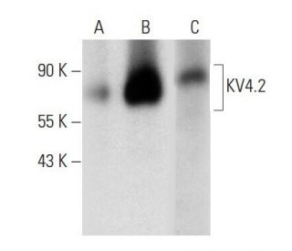 western blotting image from recommended KV4.2 (H-5) monoclonal antibody replacement. Image 289583