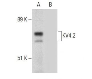 KV4.2 Antibody (H-5) - Western Blotting - Image 304566The Double Nickase Plasmid features a U6 promoter for sgRNA expression, a 20 nt targeting sequence, and a gRNA scaffold to guide Cas9n. It includes a CBh promoter for Cas9n (D10A) and puromycin resistance, GFP for transfection verification, and nuclear localization signals (NLS). The 2A peptide allows co-expression of Cas9n and Puro from a single promoter, enabling precise genome editing with reduced off-target effects.