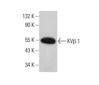 KV&beta;.1 Antibody (H-5) - Western Blotting - Image 384385 