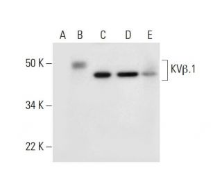KV&beta;.2 Antibody (A-3) - Western Blotting - Image 291917 