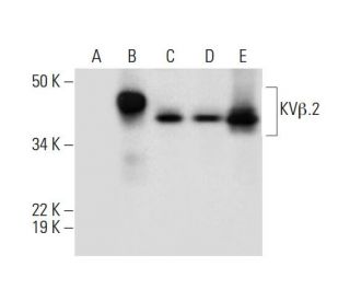 KV&beta; Antibody (F-7) - Western Blotting - Image 291915 