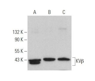 KV&beta; Antibody (H-5) - Western Blotting - Image 377445 