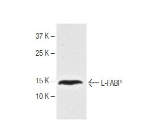 L-FABP Antibody (2G4) - Western Blotting - Image 62766