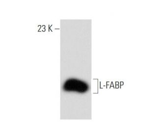 western blotting image from recommended L-FABP (F-9) monoclonal antibody replacement. Image 134759