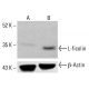 L-ficolin Antibody (005-19-1) - Western Blotting - Image 413358