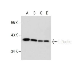 L-ficolin Antibody (FCN219) - Western Blotting - Image 324624 