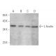 L-ficolin Antibody (FCN219) - Western Blotting - Image 371141 