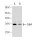 L-Mimosine: sc-201536. Western blot analysis of Cdk4 expression in untreated (A) and L-Mimosine treated (B) MDA-MB-231 who