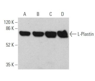 western blotting image from recommended L-Plastin (B-9) monoclonal antibody replacement. Image 360327