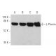 western blotting image from recommended L-Plastin (B-9) monoclonal antibody replacement. Image 360327